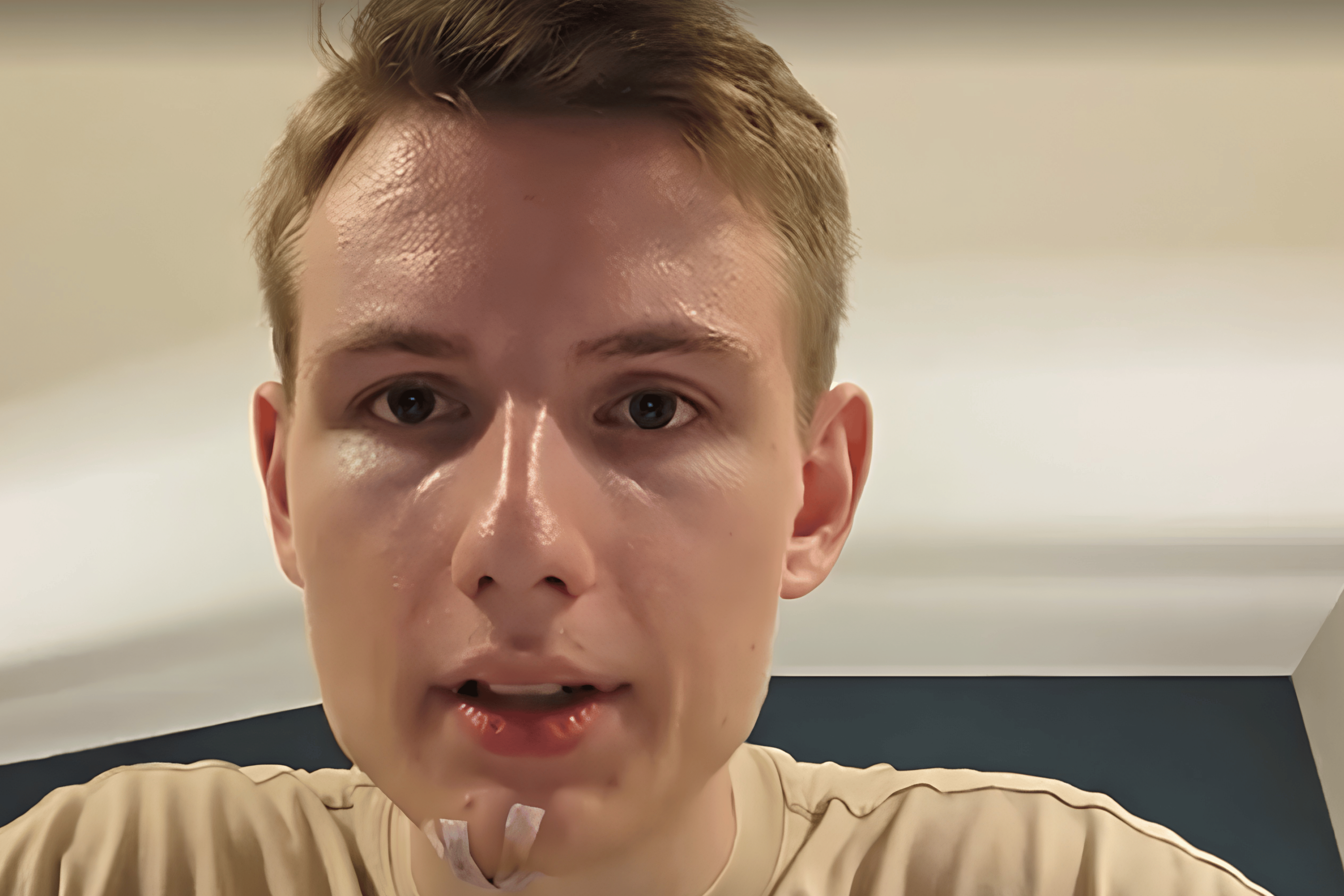 On August 18, 2026, Italian streamer itsLander was left with a bloody face after a man ran into him live on stream.